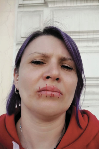 With Mouths Sewn Shut