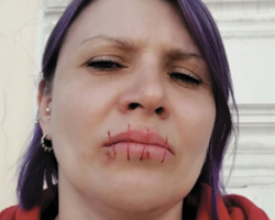 With Mouths Sewn Shut